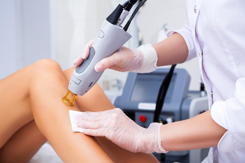 Laser Hair Removal Advertising for Social Media: A Complete Guide